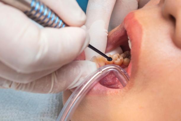 urgence dentaire Ixelles